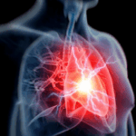 How Healthy Is Your Heart?